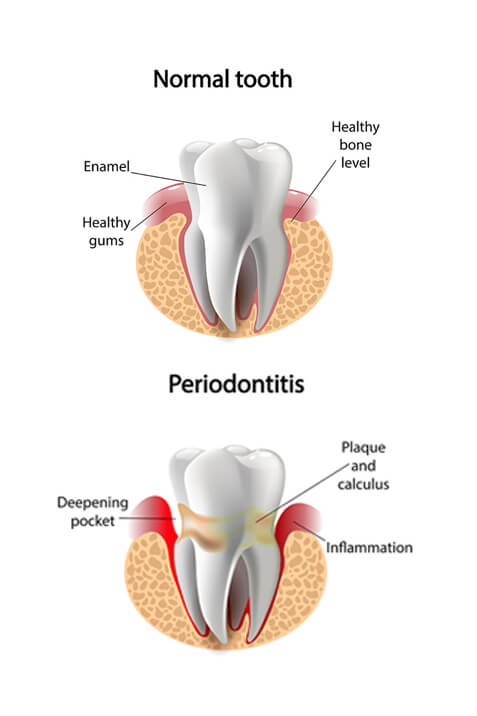 Periodontics