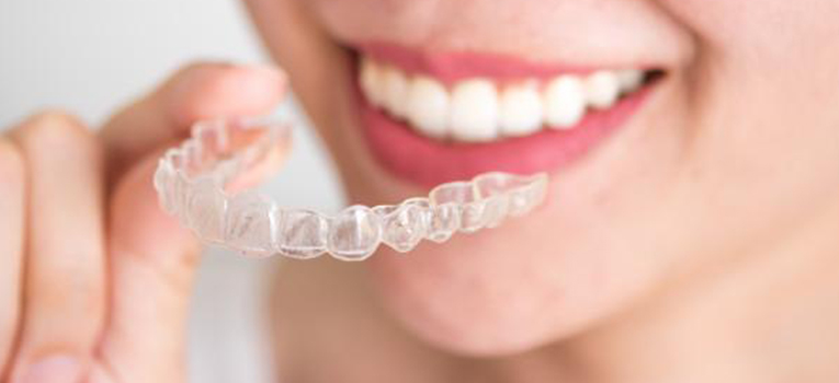 Clear Plastic Aligners