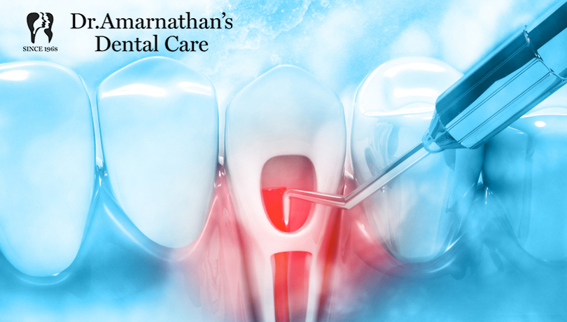 Laser-assisted Root canal treatment