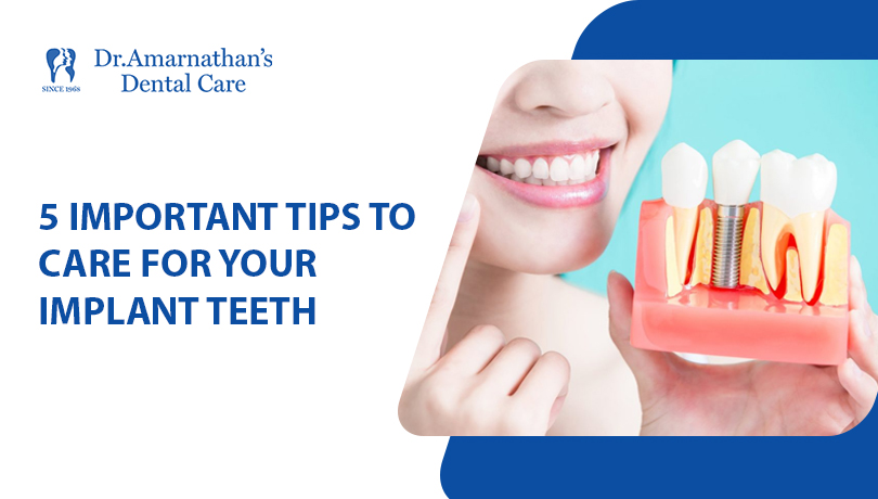 5 important tips to care for your implant teeth