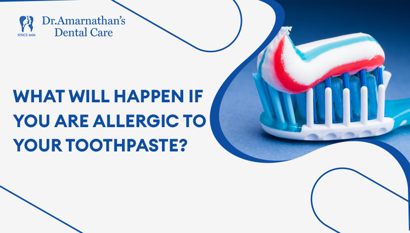 What will happen if you are allegrie to your toothpaste?