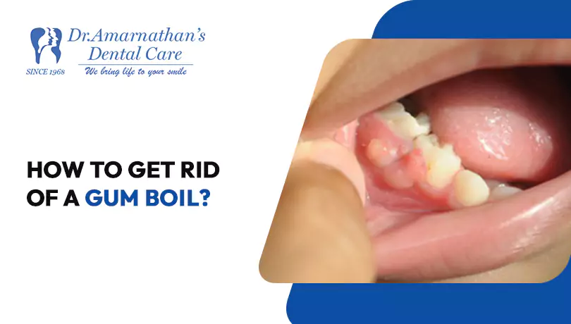 How to get rid of a gum boil