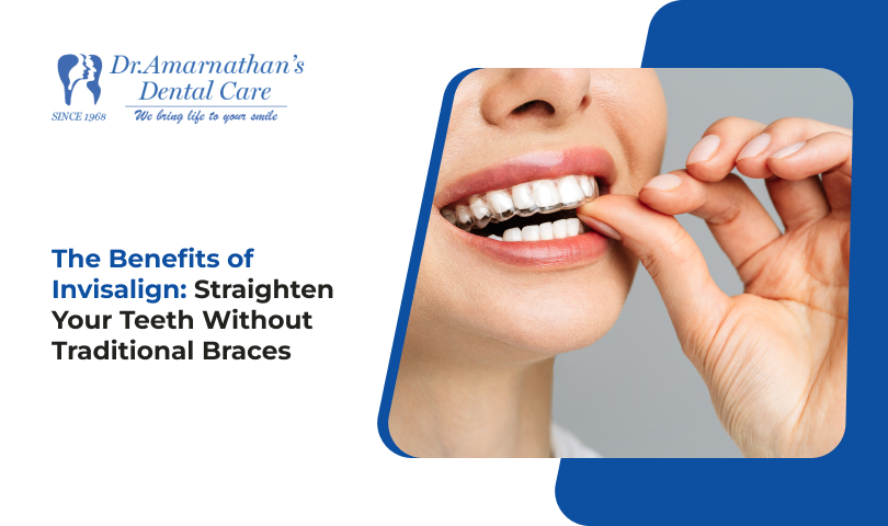 The Benefits of Invisalign: Straighten Your Teeth Without Traditional Braces