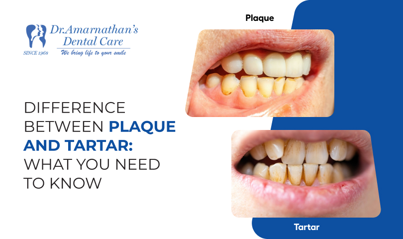 Difference Between Plaque and Tartar: What You Need to Know